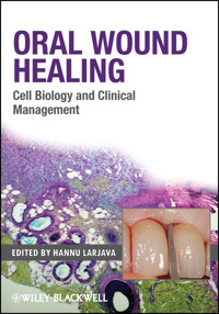Oral Wound Healing - - E-Book