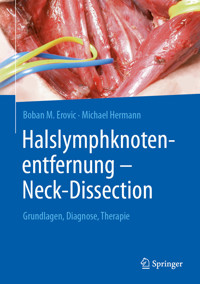 Halslymphknotenentfernung – Neck-Dissection - Boban M Erovic - E-Book
