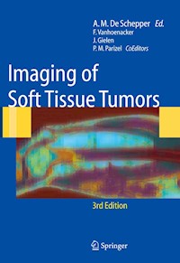 Imaging of Soft Tissue Tumors -  - E-Book