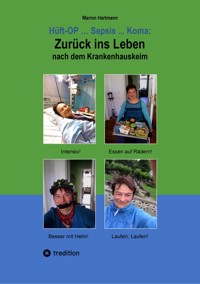 Hüft-OP ... Sepsis ... Koma: Zurück ins Leben nach dem Krankenhauskeim - Marion Hartmann - E-Book