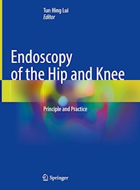 Endoscopy of the Hip and Knee -  - E-Book
