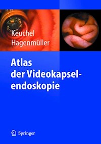 Atlas der Videokapselendoskopie - - E-Book
