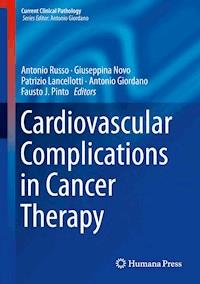Cardiovascular Complications in Cancer Therapy -  - E-Book