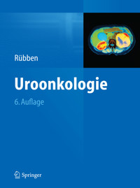 Uroonkologie -  - E-Book