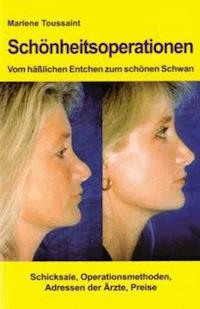 Schönheitsoperationen -Vom hässlichen Entchen zum schönen Schwan - Marlene Toussaint - E-Book