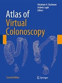 Atlas of Virtual Colonoscopy -  - E-Book