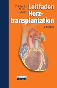 Leitfaden Herztransplantation - Christof Schmid - E-Book