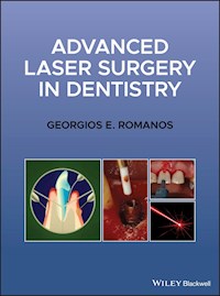 Advanced Laser Surgery in Dentistry - Georgios E. Romanos - E-Book