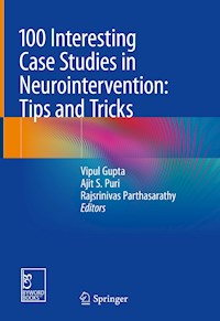 100 Interesting Case Studies in Neurointervention: Tips and Tricks - - E-Book