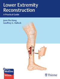 Lower Extremity Reconstruction - Joon Pio Hong - E-Book