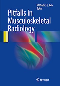 Pitfalls in Musculoskeletal Radiology -  - E-Book