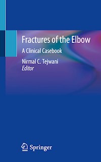 Fractures of the Elbow -  - E-Book