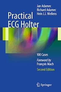 Practical ECG Holter -  - E-Book