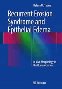 Recurrent Erosion Syndrome and Epithelial Edema - Helena M. Tabery - E-Book