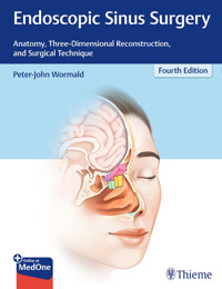 Endoscopic Sinus Surgery - Peter J. Wormald - E-Book