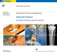 AO Manual of Fracture Management: Internal Fixators - Michael Wagner - E-Book