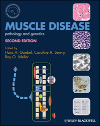 Muscle Disease -  - E-Book