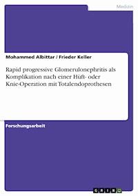 Rapid progressive Glomerulonephritis als Komplikation nach einer Hüft- oder Knie-Operation mit Totalendoprothesen - Mohammed Albittar - E-Book
