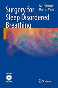 Surgery for Sleep Disordered Breathing - Karl Hörmann - E-Book