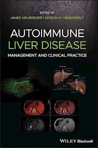 Autoimmune Liver Disease -  - E-Book