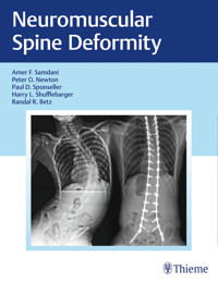 Neuromuscular Spine Deformity -  - E-Book