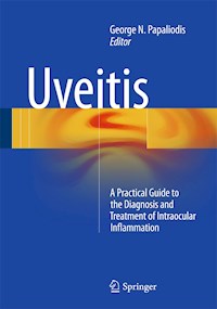 Uveitis -  - E-Book