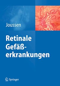 Retinale Gefäßerkrankungen - - E-Book