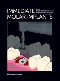 Immediate Molar Implants - Douglas Deporter - E-Book
