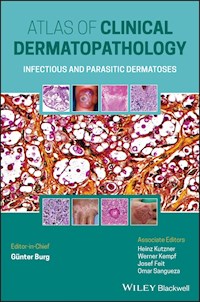 Atlas of Clinical Dermatopathology - Gunter Burg - E-Book