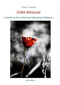 Cette blessure - Frédéric Hoebeeck - E-Book