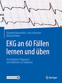 EKG an 60 Fällen lernen und üben - Elisabeth Ratzenböck - E-Book