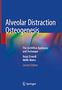 Alveolar Distraction Osteogenesis - Nejat Erverdi - E-Book