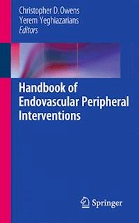 Handbook of Endovascular Peripheral Interventions - - E-Book