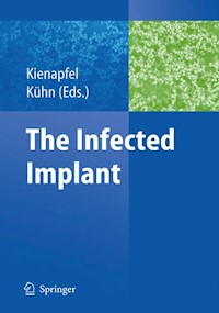 The Infected Implant -  - E-Book