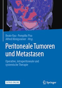Peritoneale Tumoren und Metastasen -  - E-Book