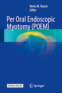 Per Oral Endoscopic Myotomy (POEM) -  - E-Book