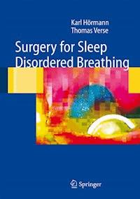 Surgery for Sleep-Disordered Breathing - Karl Hörmann - E-Book