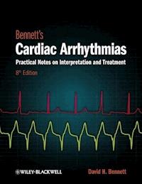 Bennett's Cardiac Arrhythmias - David H. Bennett - E-Book