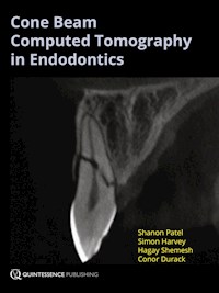 Cone Beam Computed Tomography in Endodontics - Shanon Patel - E-Book