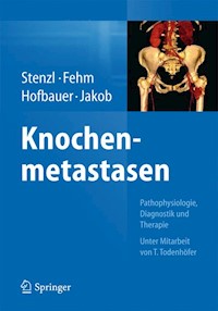 Knochenmetastasen -  - E-Book