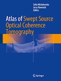 Atlas of Swept Source Optical Coherence Tomography - - E-Book