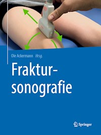 Fraktursonografie -  - E-Book