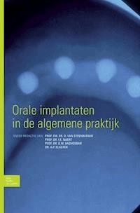 Orale implantaten in de algemene praktijk - - E-Book