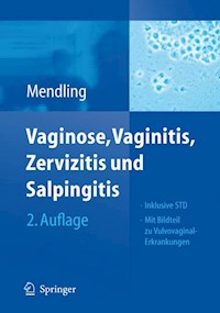 Vaginose, Vaginitis, Zervizitis und Salpingitis - Werner Mendling - E-Book