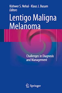 Lentigo Maligna Melanoma -  - E-Book