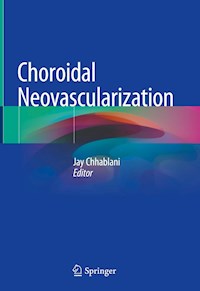 Choroidal Neovascularization -  - E-Book