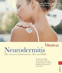 Neurodermitis - Dietlinde Burkhardt - E-Book