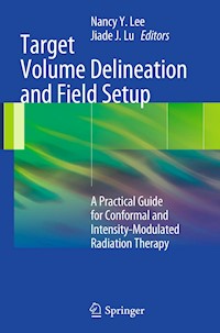 Target Volume Delineation and Field Setup -  - E-Book