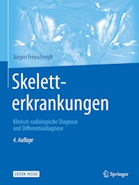Skeletterkrankungen - Jürgen Freyschmidt - E-Book