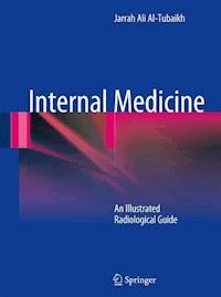 Internal Medicine - Jarrah Ali Al-Tubaikh - E-Book